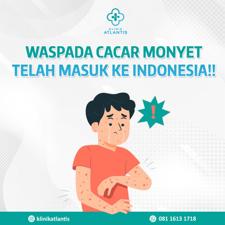 waspada cacar monyet telah masuk ke Indonesia