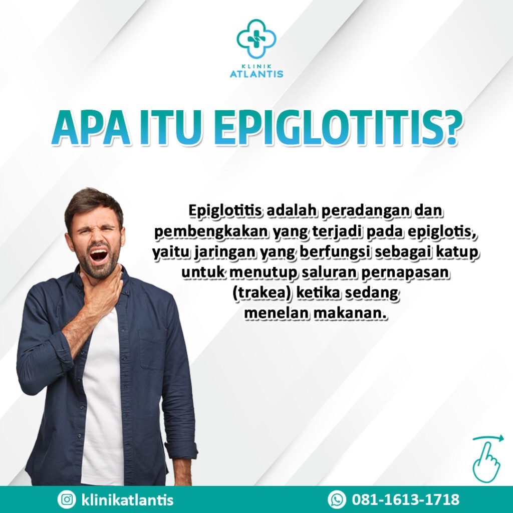 epiglotitis