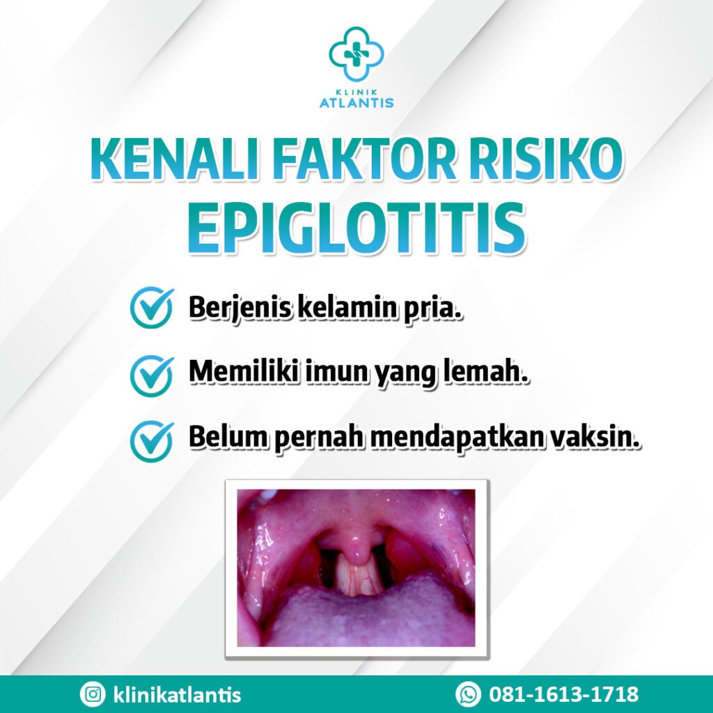 faktor resiko epiglotitis
