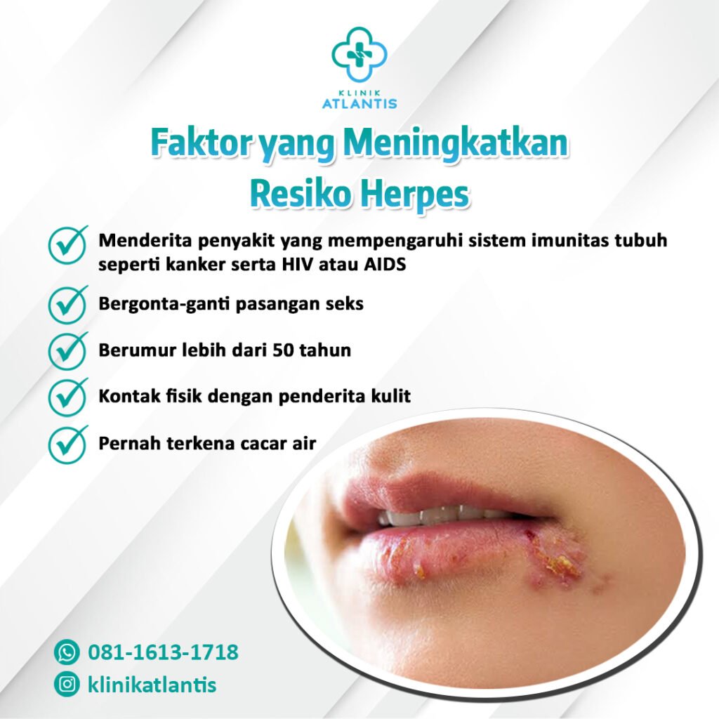 faktor meningkatnya resiko herpes