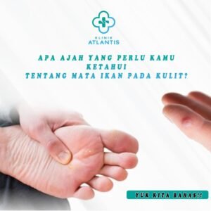 apa itu mata ikan?