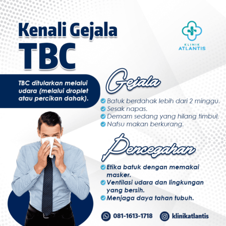 Kenali Gejala TBC 1 Kenali Gejala TBC 1