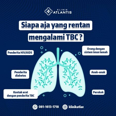 Kenali Gejala TBC 2 Kenali Gejala TBC 2